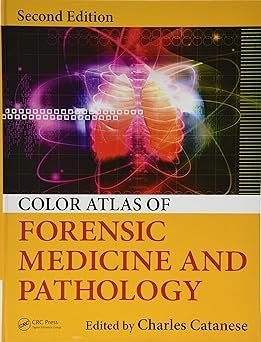 The gold standard of neuroscience texts―updated with hundreds of brand-new images and fully revised content in every chapter A Doody's Core Titles for 2024 & 2023! For more than 40 years, Principles of Neural Science has helped readers understand the link between the human brain and behavior. As the renowned text has shown, all behavior is an expression of neural activity and the future of both clinical neurology and psychiatry is dependent on the progress of neural science. Fully updated, this sixth edition of the landmark reference reflects the latest research, clinical perspectives, and advances in the field. It offers an unparalleled perspective on the the current state and future of neural science. This new edition features: Unmatched coverage of how the nerves, brain, and mind function NEW chapters on: - The Computational Bases of Neural Circuits that Mediate Behavior - Brain-Machine Interfaces - Decision-Making and Consciousness NEW section on the neuroscientific principles underlying the disorders of the nervous system Expanded coverage of the different forms of human memory Highly detailed chapters on stroke, Parkinson’s disease, and multiple sclerosis 2,200 images, including 300 new color illustrations, diagrams, radiology studies, and PET scans Principles of Neural Science, Sixth Edition benefits from a cohesive organization, beginning with an insightful overview of the interrelationships between the brain, nervous system, genes, and behavior. The text is divided into nine sections: Part I: Overall Perspective provides an overview of the broad themes of neural science, including the basic anatomical organization of the nervous system and the genetic bases of nervous system function and behavior. Part II: Cell and Molecular Biology of Cells of the Nervous System examines the basic properties of nerve cells, including the generation and conduction of propagated signaling. Part III: Synaptic Transmission focuses on the electrophysiological and molecular mechanism of synaptic transmission with chapters on neuronal excitability, neurotransmitters, and transmitter release. Part IV: Perception discusses the various aspects of sensory perception, including how information from the primary organs of sensation is transmitted to and processed by the central nervous system. Part V: Movement considers the neural mechanisms underlying movement and examines a new treatment that addresses how the basal ganglia regulate the selection of motor actions and instantiate reinforcement learning. Part VI: The Biology of Emotion, Motivation and Homeostasis examines the neural mechanisms by which subcortical areas mediate homeostatic control mechanisms, emotions, and motivation. Part VII: Development and the Emergence of Behavior looks at the nervous system from early embryonic differentiation to the formation and elimination of synapses. Part VIII: Learning, Memory, Language and Cognition expands on the previous section, examining the cellular mechanisms of implicit and explicit memory storage, as well as decision-making and consciousness. Part IX: explores the neural mechanisms underlying diseases and disorders of the nervous system, including autism spectrum disorder, epilepsy, schizophrenia, and anxiety.